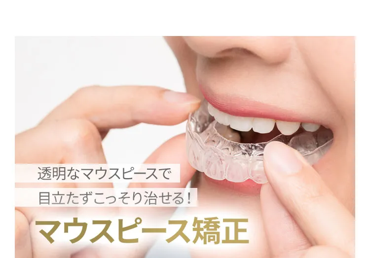 マウスピース矯正
